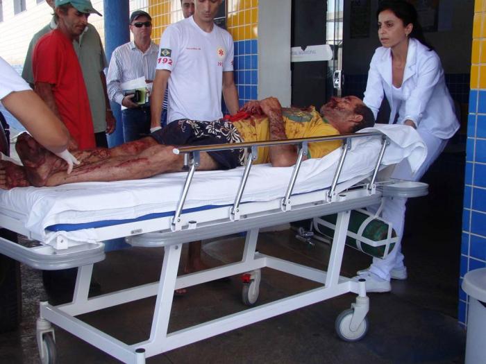 Trabalhador rural fica gravemente ferido em acidente com ensiladeira em Presidente Olegário