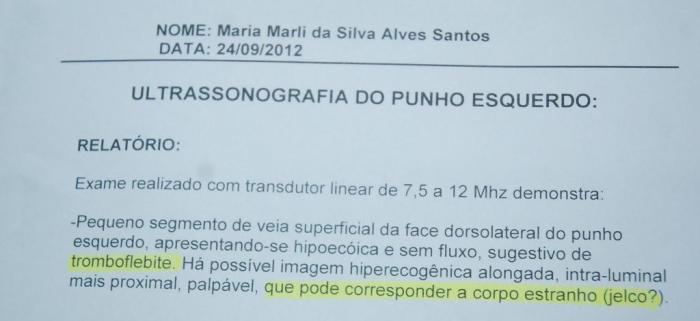 Mulher diz que funcionária deixou agulha em seu braço