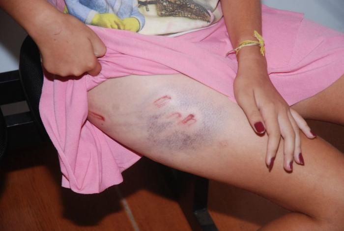 Pai espanca filha brutalmente em Lagoa Grande e é preso