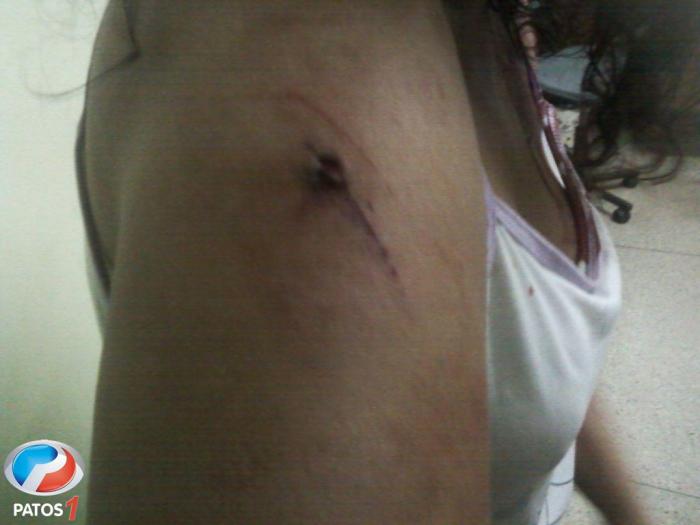 Marido tenta matar esposa em Lagoa Formosa