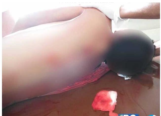 Homem de 29 anos é morto com golpe de faca na cidade de Serra do Salitre
