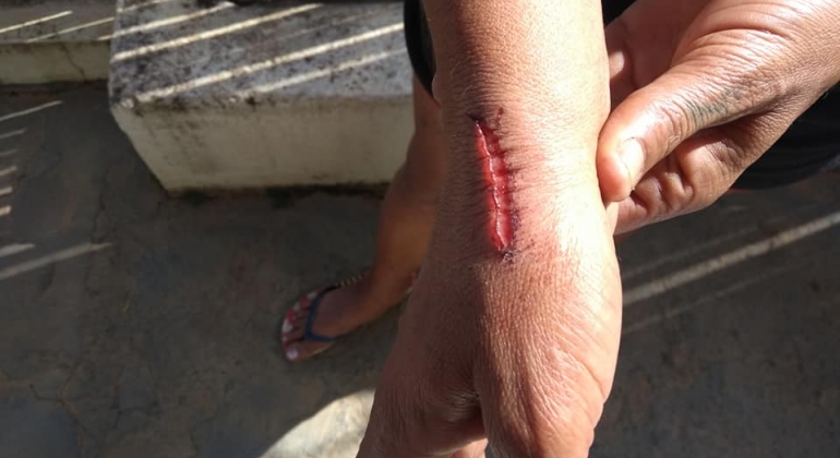 Após separação mulher é agredida e esfaqueada pelo ex-marido em Carmo do Paranaíba