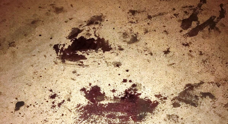 Homem de 40 anos é esfaqueado em Lagoa Formosa e socorrido com as vísceras expostas