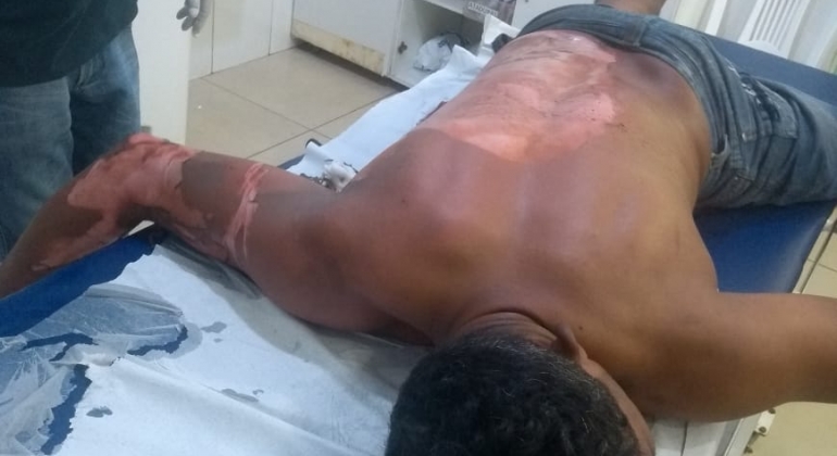 Homem ateia fogo em colega após discussão na cidade de São Gotardo Homem ateia fogo em colega após discussão na cidade de São Gotardo