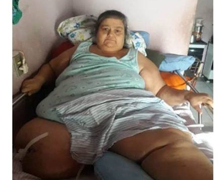 Mulher de quase 200 quilos que teve perna amputada precisa de ajuda para comprar cadeira de rodas e de banho