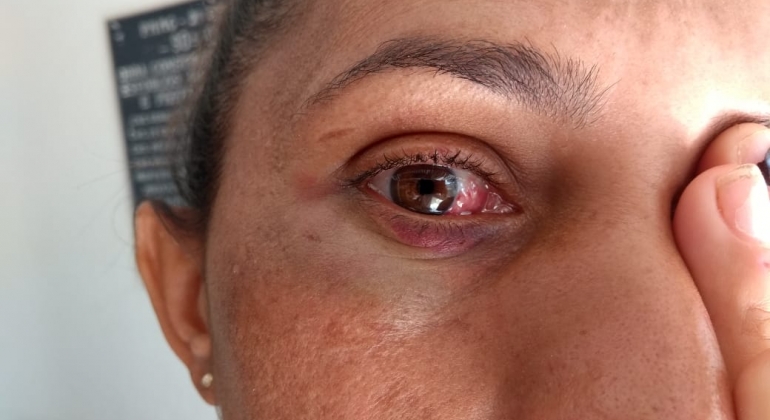 Briga em Carmo do Paranaíba termina com mulher de 35 anos ferida Briga em Carmo do Paranaíba termina com mulher de 35 anos ferida