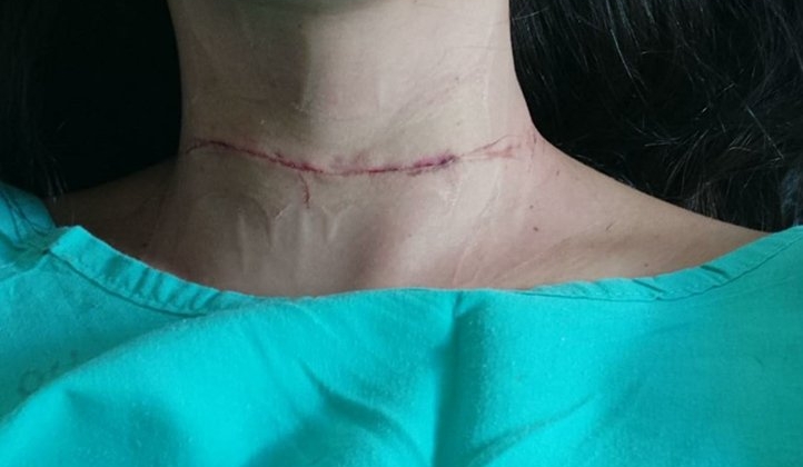 Após cirurgia motociclista atingida por linha de pipa diz que passa bem