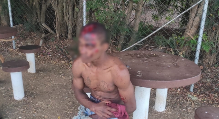 Indivíduos que usavam drogas em dependência de escola brigam e homem fica gravemente ferido Indivíduos que usavam drogas em dependência de escola brigam e homem fica gravemente ferido