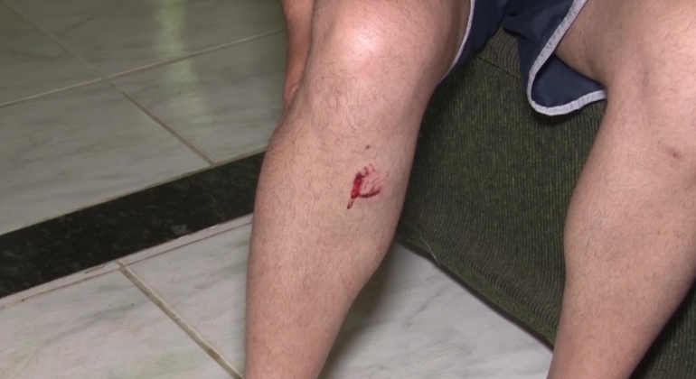 Leiturista é atacado por cães pitbull, no Bairro Jardim Panorâmico em Patos de Minas Leiturista é atacado por cães pitbull, no Bairro Jardim Panorâmico em Patos de Minas