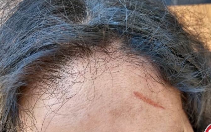Briga em casa de forró termina com homem esfaqueado e três mulheres detidas Briga em casa de forró termina com homem esfaqueado e três mulheres detidas