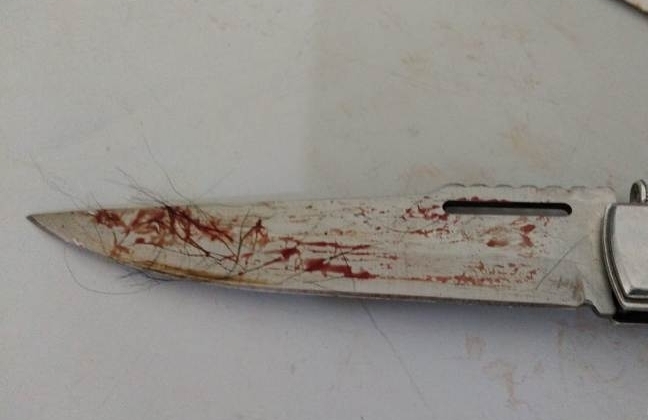 Rapaz desfere golpe de canivete em cachorro de vizinho em Patos de Minas