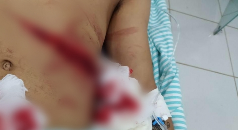 Seis pessoas ficam feridas após serem atingidas por golpes de canivete no Distrito de Monjolinho