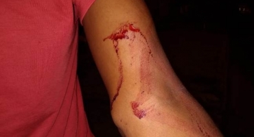 Briga por causa de alto volume de som termina com rapaz esfaqueando pai e irmão Briga por causa de alto volume de som termina com rapaz esfaqueando pai e irmão