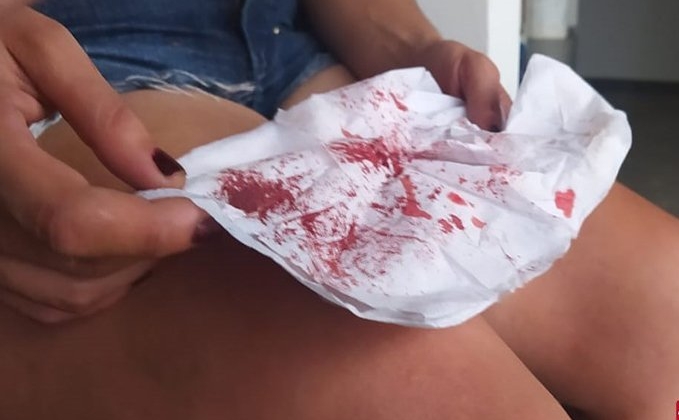 Desentendimento no Bairro Jardim Aquárius em Patos de Minas termina com mulheres na delegacia