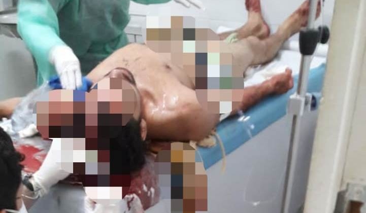 Carmo do Paranaíba: rapaz de 24 anos é atingido na cabeça por golpe de faca desferido por mulher Carmo do Paranaíba: rapaz de 24 anos é atingido na cabeça por golpe de faca desferido por mulher