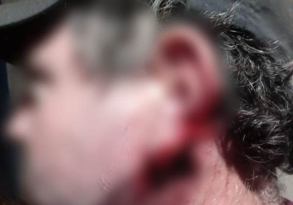 Homem tem parte da orelha dilacerada após briga por acerto de drogas em Lagamar