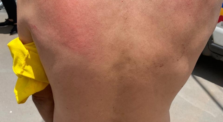 Rapaz é agredido em via pública na cidade de Lagoa Formosa Rapaz é agredido em via pública na cidade de Lagoa Formosa