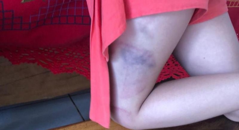 Mãe é presa após agredir filhos de 7 e 12 anos no Bairro Nossa Senhora de Fátima em Patos de Minas