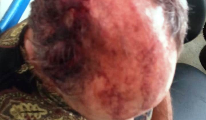 Durante bebedeira homem atinge colega com cadeirada na cabeça em Carmo do Paranaíba 