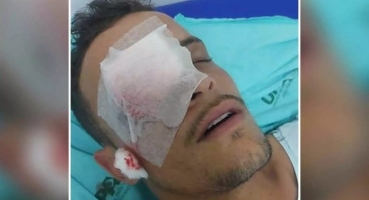 Jovem que teve um dos olhos furado por ex-namorada é transferido para hospital de Belo Horizonte