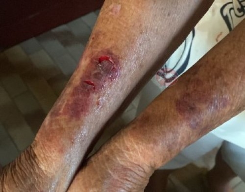 Patos de Minas - Homem é preso após agredir a própria mãe de 79 anos e causar danos à residência Patos de Minas - Homem é preso após agredir a própria mãe de 79 anos e causar danos à residência