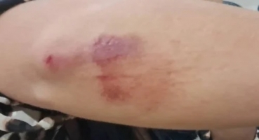 Patos de Minas - Mulher é agredida pelo companheiro e arrastada no asfalto Patos de Minas - Mulher é agredida pelo companheiro e arrastada no asfalto