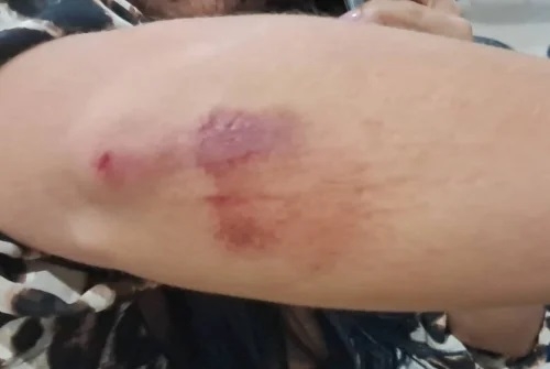Patos de Minas - Mulher é agredida pelo companheiro e arrastada no asfalto Patos de Minas - Mulher é agredida pelo companheiro e arrastada no asfalto