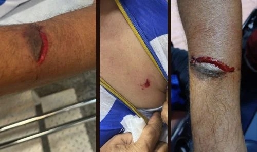 Patos de Minas - Clássico Mamoré x URT termina com tumulto, bomba e torcedores feridos Patos de Minas - Clássico Mamoré x URT termina com tumulto, bomba e torcedores feridos