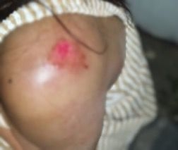 Mulher é agredida pelo companheiro em Patos de Minas; após recusar fazer sexo dentro de carro Mulher é agredida pelo companheiro em Patos de Minas; após recusar fazer sexo dentro de carro