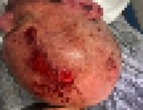 Homem embriagado é brutalmente agredido após urinar em via pública na cidade de Patos de Minas Homem embriagado é brutalmente agredido após urinar em via pública na cidade de Patos de Minas