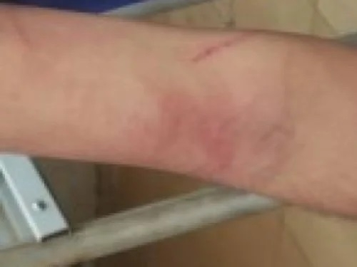 Jovem vai a empresa de segurança em Patos de Minas devolver uniforme e pegar pagamento, mas acaba sendo agredido no local