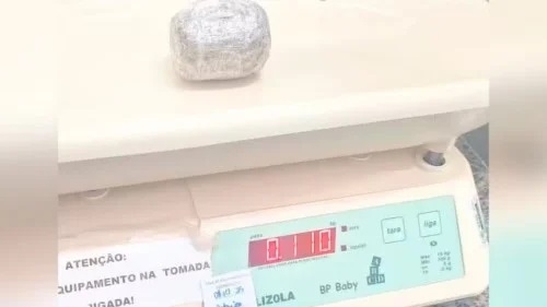 Mulher é detida após descoberta de droga escondida no ânus durante procedimento cirúrgico Mulher é detida após descoberta de droga escondida no ânus durante procedimento cirúrgico