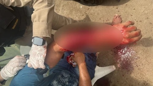 Mulher é presa por esfaquear ex-companheiro após encontrá-lo com outra mulher na casa dele; em Patrocínio